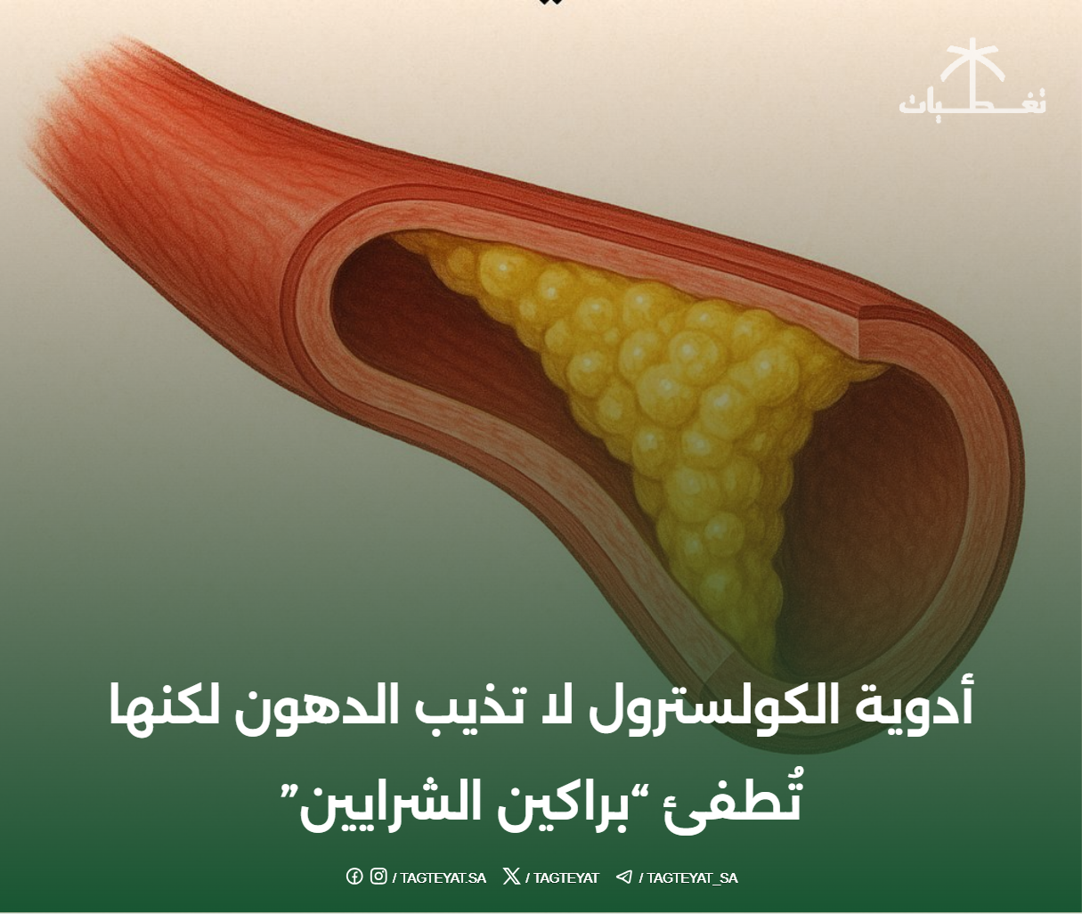 أدوية الكولسترول لا تذيب الدهون لكنها تُطفئ "براكين الشرايين"